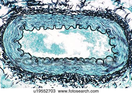 Renal artery View Large Photo Image Stock Image - Renal artery. Fotosearch