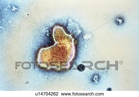 Respiratory syncytial virus View Large Photo Image Stock Image - Respiratory syncytial virus. Fotosearch