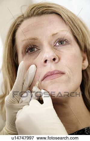 Restylane treatment View Large Photo Image Stock Photo - Restylane treatment. Fotosearch