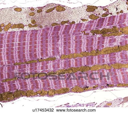 Skeletal muscle and tendon, TEM View Large Photo Image Stock Image - Skeletal muscle and tendon, TEM. Fotosearch