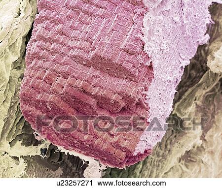 Stock Image - Skeletal muscle fibre, SEM. Fotosearch