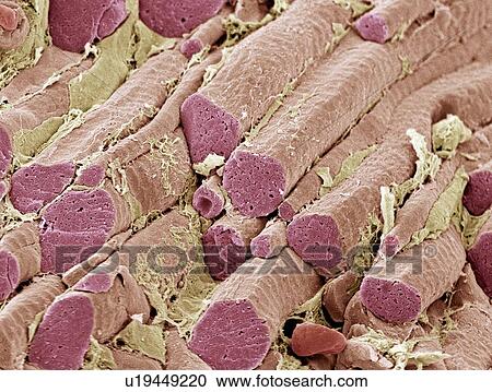 Skeletal muscle fibres, SEM View Large Photo Image Stock Image - Skeletal muscle fibres, SEM. Fotosearch