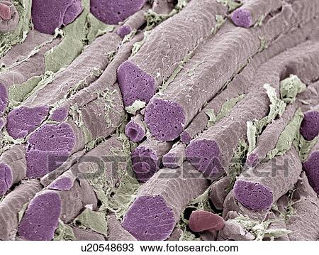 Stock Image - Skeletal muscle fibres, SEM. Fotosearch
