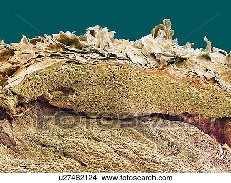 Picture - Skin, SEM. Fotosearch
