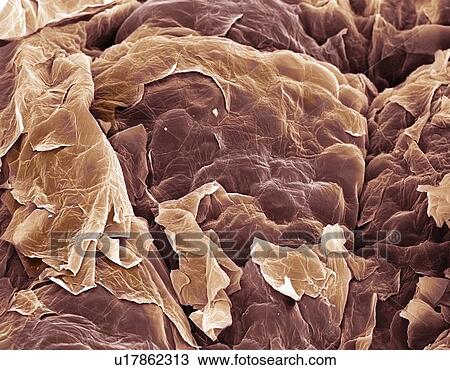 Skin, SEM View Large Photo Image Stock Image - Skin, SEM. Fotosearch