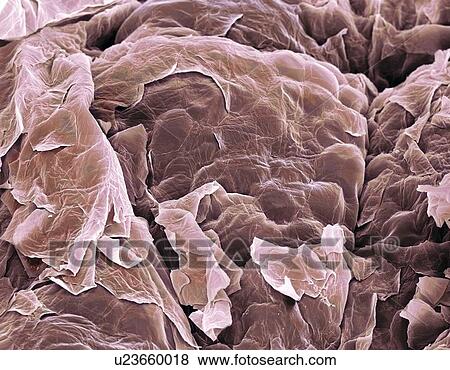 Skin, SEM View Large Photo Image Stock Photo - Skin, SEM. Fotosearch