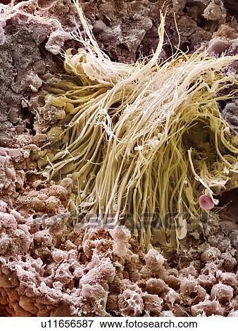Sperm production site, SEM View Large Photo Image Stock Photo - Sperm production site, SEM. Fotosearch