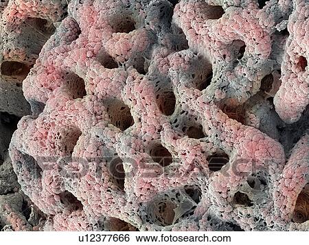 Stomach lining with gastric pits, SEM View Large Photo Image Stock Photograph - Stomach lining with gastric pits, SEM. Fotosearch