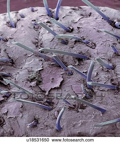 Stock Image - Stubble, SEM. Fotosearch