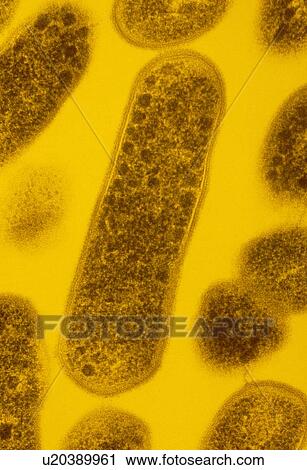 TEM of Gardnerella vaginalis bacteria View Large Photo Image Stock Image - TEM of Gardnerella vaginalis bacteria. Fotosearch