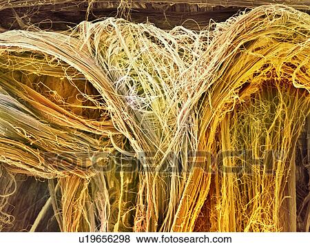 Stock Photo - Tendon fibres, SEM. Fotosearch