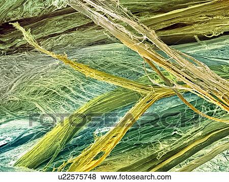 Stock Photo - Tendon fibres, SEM. Fotosearch