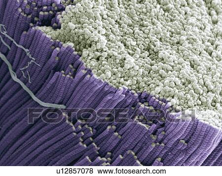 Stock Photo - Tendon, SEM. Fotosearch