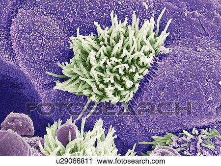 Stock Image - Trachea lining, SEM. Fotosearch