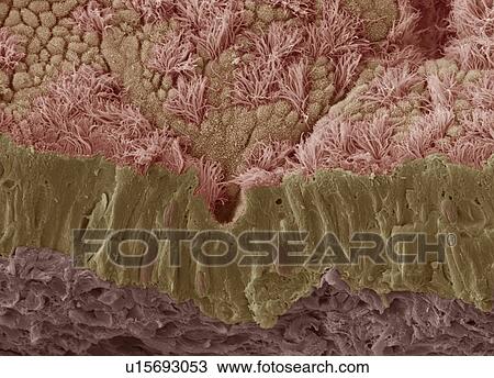 Trachea mucous membrane, SEM View Large Photo Image Stock Image - Trachea mucous membrane, SEM. Fotosearch