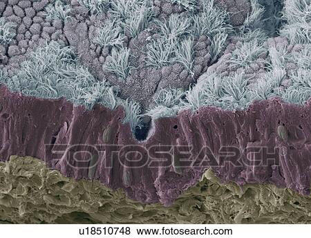 Stock Photo - Trachea mucous membrane, SEM. Fotosearch