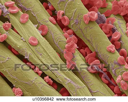 Used surgical swab, SEM View Large Photo Image Stock Image - Used surgical swab, SEM. Fotosearch