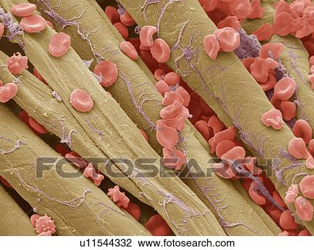 Used surgical swab, SEM View Large Photo Image Stock Image - Used surgical swab, SEM. Fotosearch