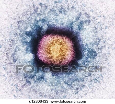 Stock Image - Vaccinia virus particle, TEM. Fotosearch