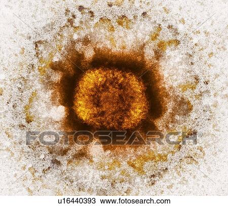 Stock Image - Vaccinia virus particle, TEM. Fotosearch