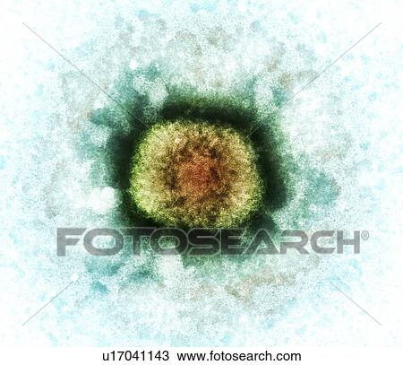Vaccinia virus particle, TEM View Large Photo Image Stock Image - Vaccinia virus particle, TEM. Fotosearch