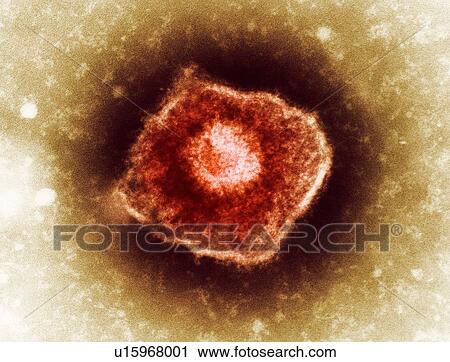 Stock Image - Varicella zoster virus particle, TEM. Fotosearch