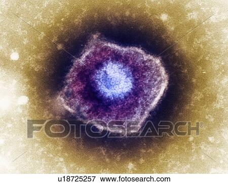 Stock Photo - Varicella zoster virus particle, TEM. Fotosearch
