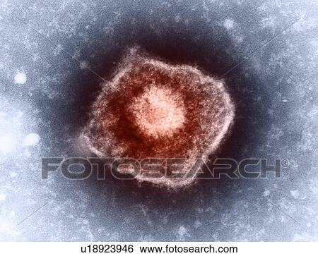 Stock Photograph - Varicella zoster virus particle, TEM. Fotosearch