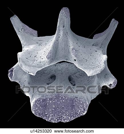 Stock Image - Vertebra, SEM. Fotosearch