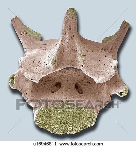 Stock Image - Vertebra, SEM. Fotosearch