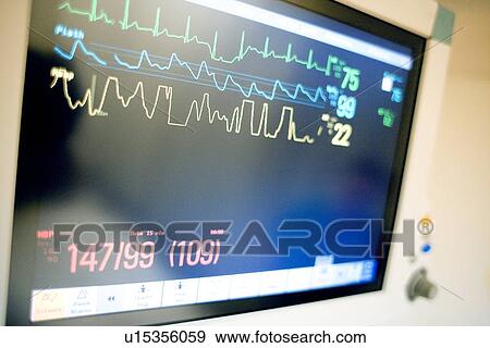 Stock Photo - Vital signs monitor. Fotosearch