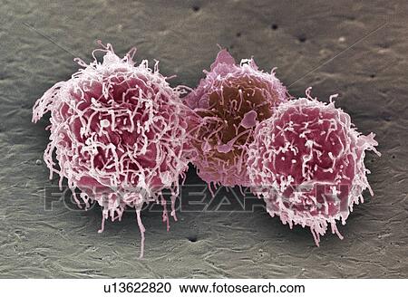 White blood cells, SEM View Large Photo Image Stock Image - White blood cells, SEM. Fotosearch