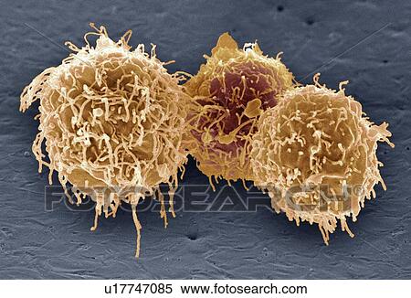 Stock Photography - White blood cells, SEM. Fotosearch