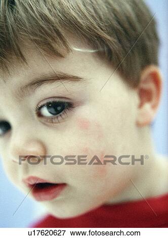 Stock Photo - Young boy's face. Fotosearch