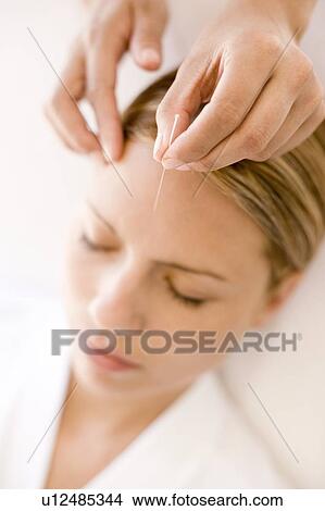 Picture - Acupuncture. Fotosearch