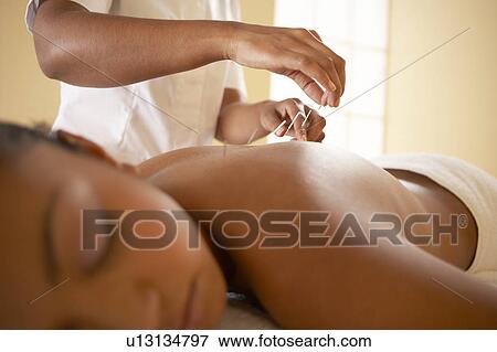 Stock Photo - Acupuncture. Fotosearch