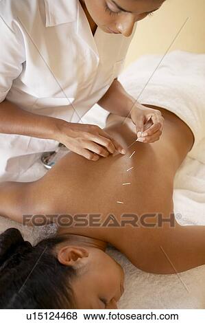Stock Photo - Acupuncture. Fotosearch