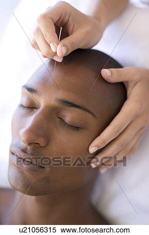 Acupuncture View Large Photo Image Stock Photography - Acupuncture. Fotosearch