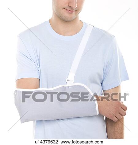 Arm in a sling View Large Photo Image Stock Image - Arm in a sling. Fotosearch