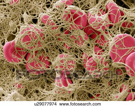 Blood clot, SEM View Large Photo Image Picture - Blood clot, SEM. Fotosearch
