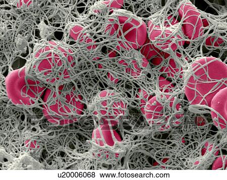 Stock Photo - Blood clot, SEM. Fotosearch