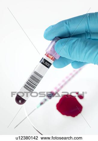 Blood research View Large Photo Image Stock Image - Blood research. Fotosearch