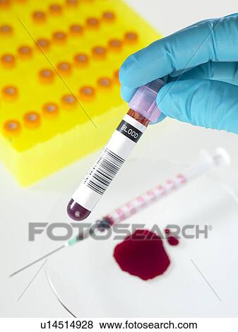 Stock Photo - Blood research. Fotosearch