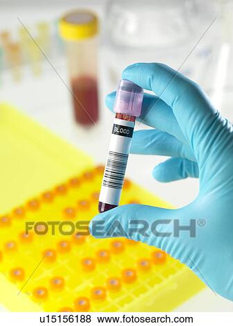 Stock Photo - Blood research. Fotosearch