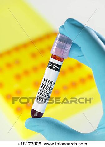 Stock Photography - Blood research. Fotosearch