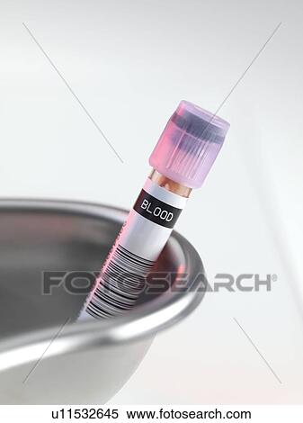 Stock Photography - Blood sample. Fotosearch