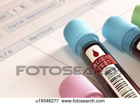 Stock Photo - Blood samples for testing in vials. Fotosearch