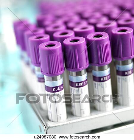 Stock Image - Blood sampling tubes. Fotosearch