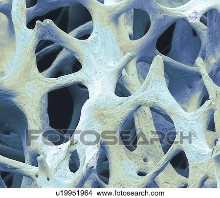 Picture - Bone tissue, SEM. Fotosearch