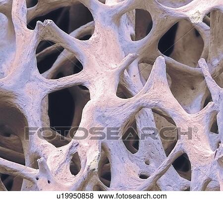 Stock Photo - Bone tissue, SEM. Fotosearch